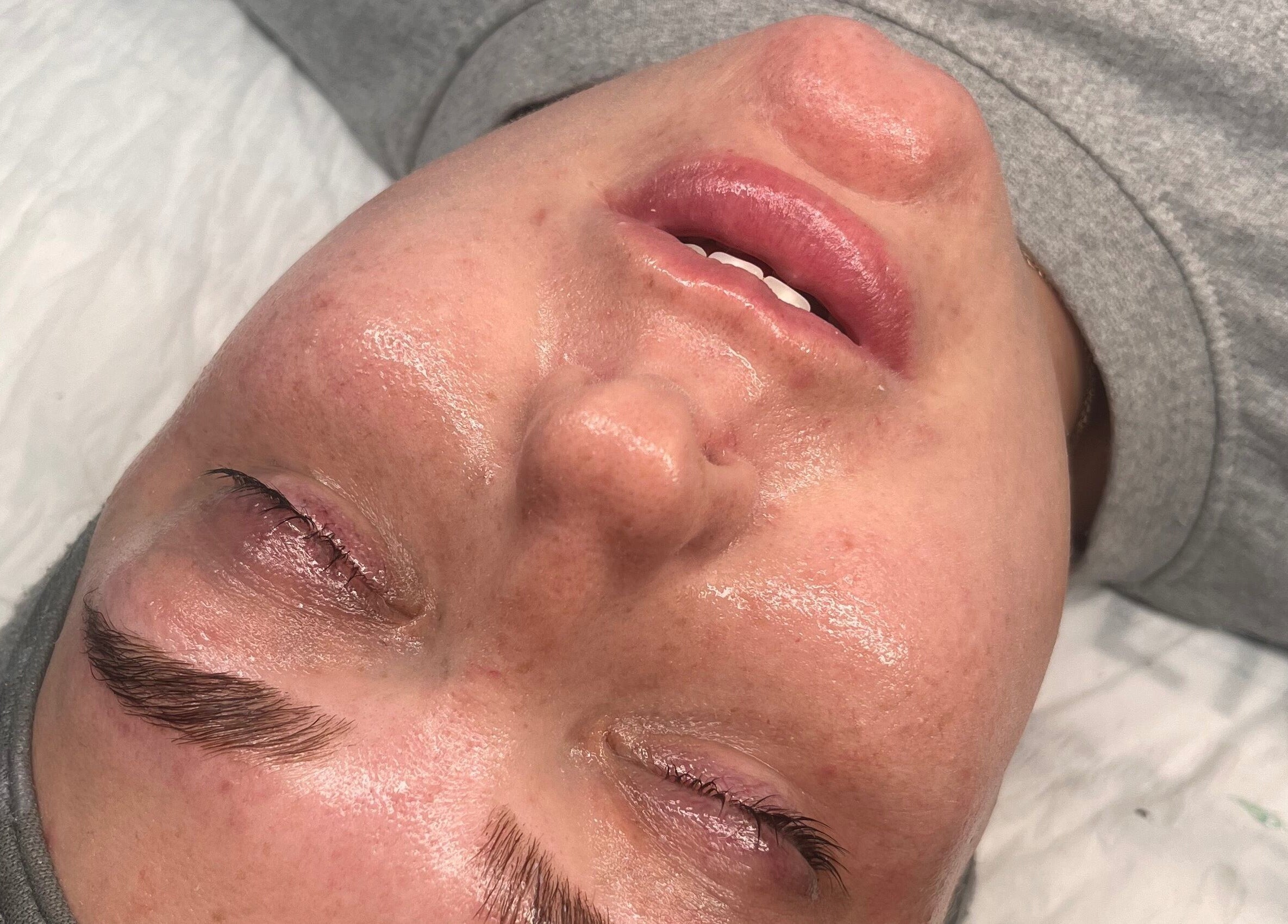 Close-up of a serene facial treatment at Natural Aesthetics, Stoke-on-Trent, England, GB.