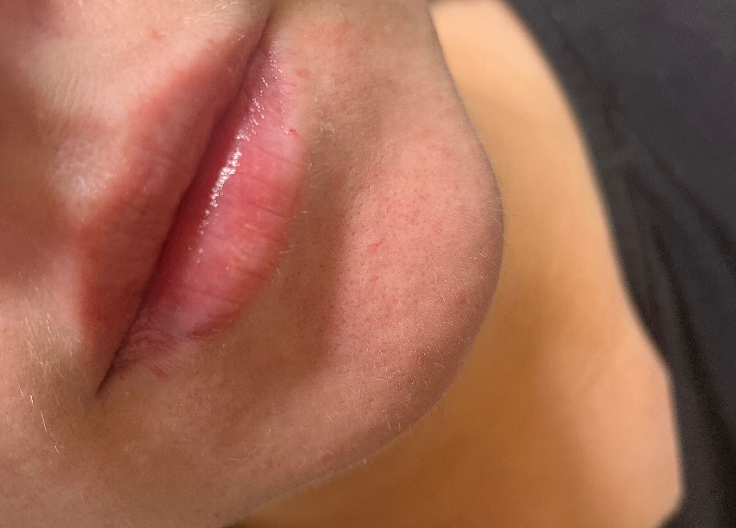 Close-up of glossy lips, highlighting skincare at Natural Aesthetics, Stoke-on-Trent, England, GB.