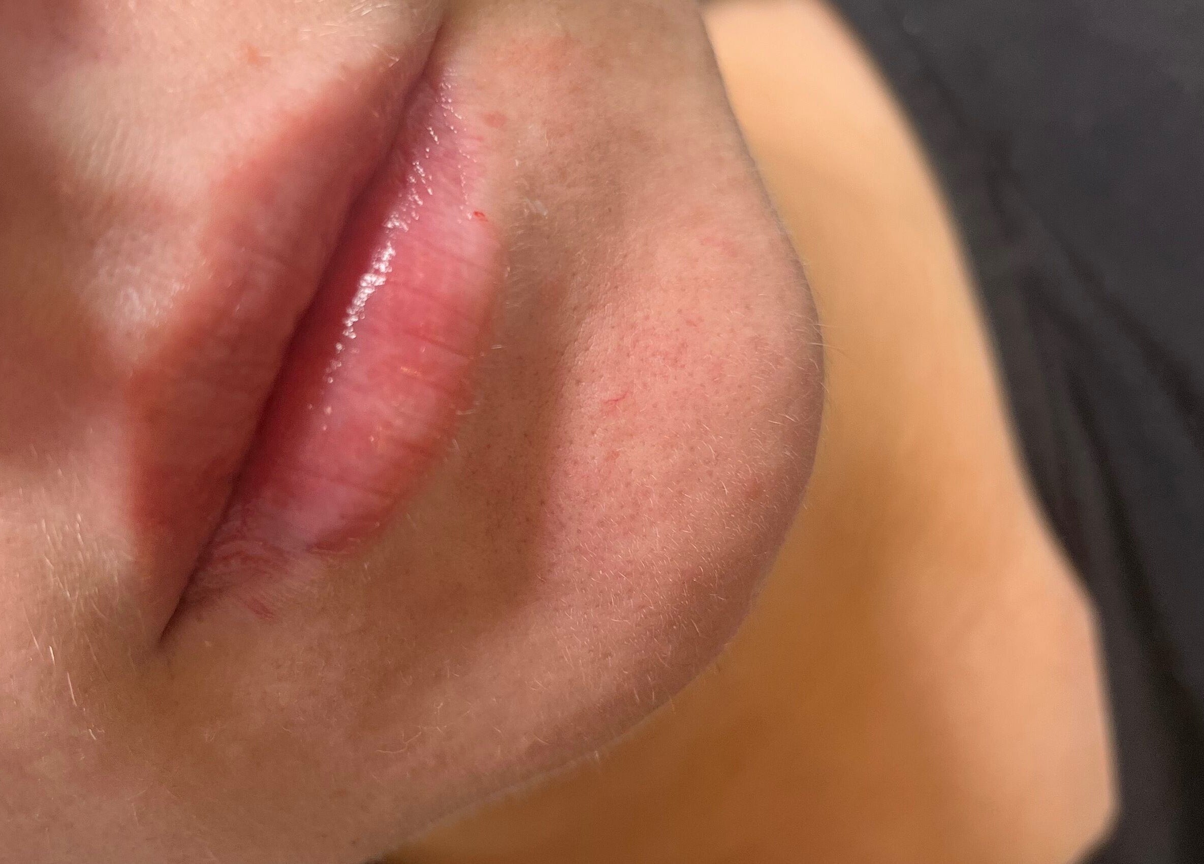 Close-up of glossy lips, highlighting skincare at Natural Aesthetics, Stoke-on-Trent, England, GB.