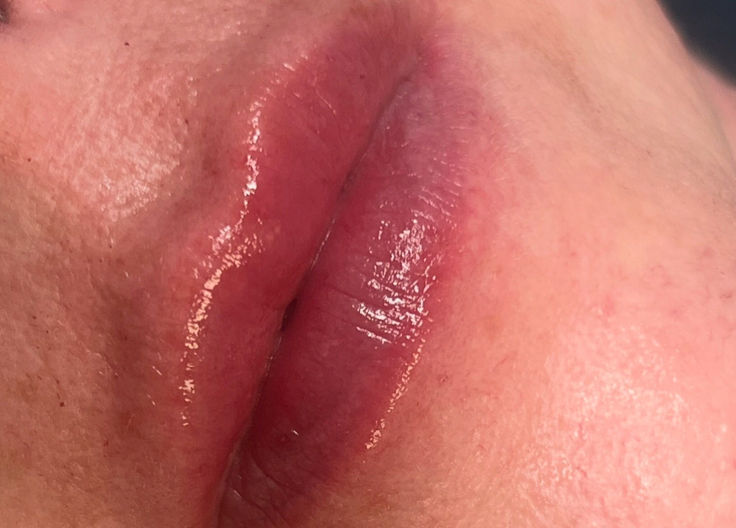 Close-up of glossy lips after treatment at Natural Aesthetics in Stoke-on-Trent, England, GB.