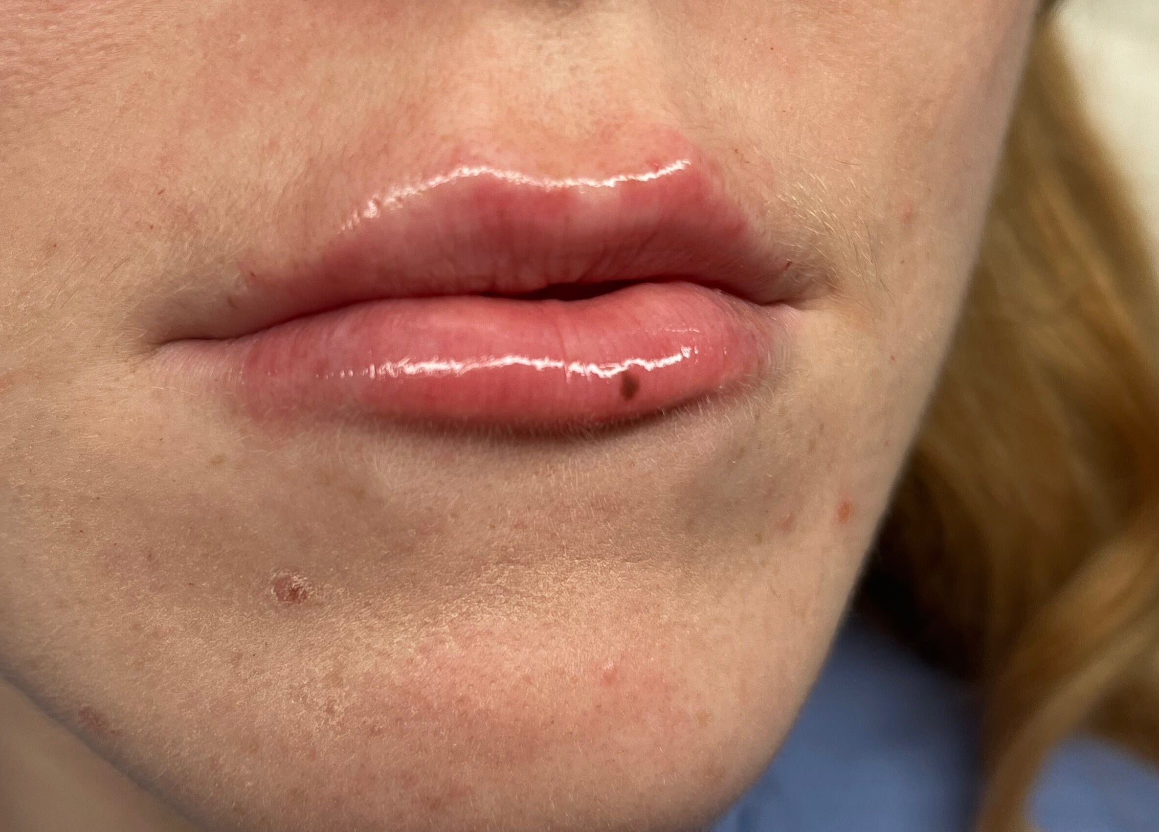 Close-up of glossy lips after treatment at Natural Aesthetics, Stoke-on-Trent, England, GB.