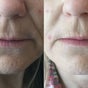 Manor Lodge Beauty CASTLE CARY-Dr John Buckmaster Aesthetics