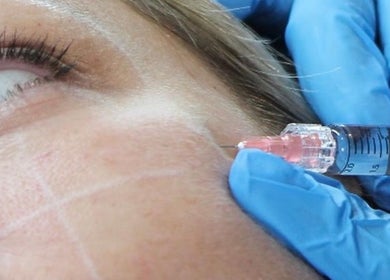 Nurse Injector Michelle providing expert filler treatment in Lowestoft, England, GB, promoting youthful skin.