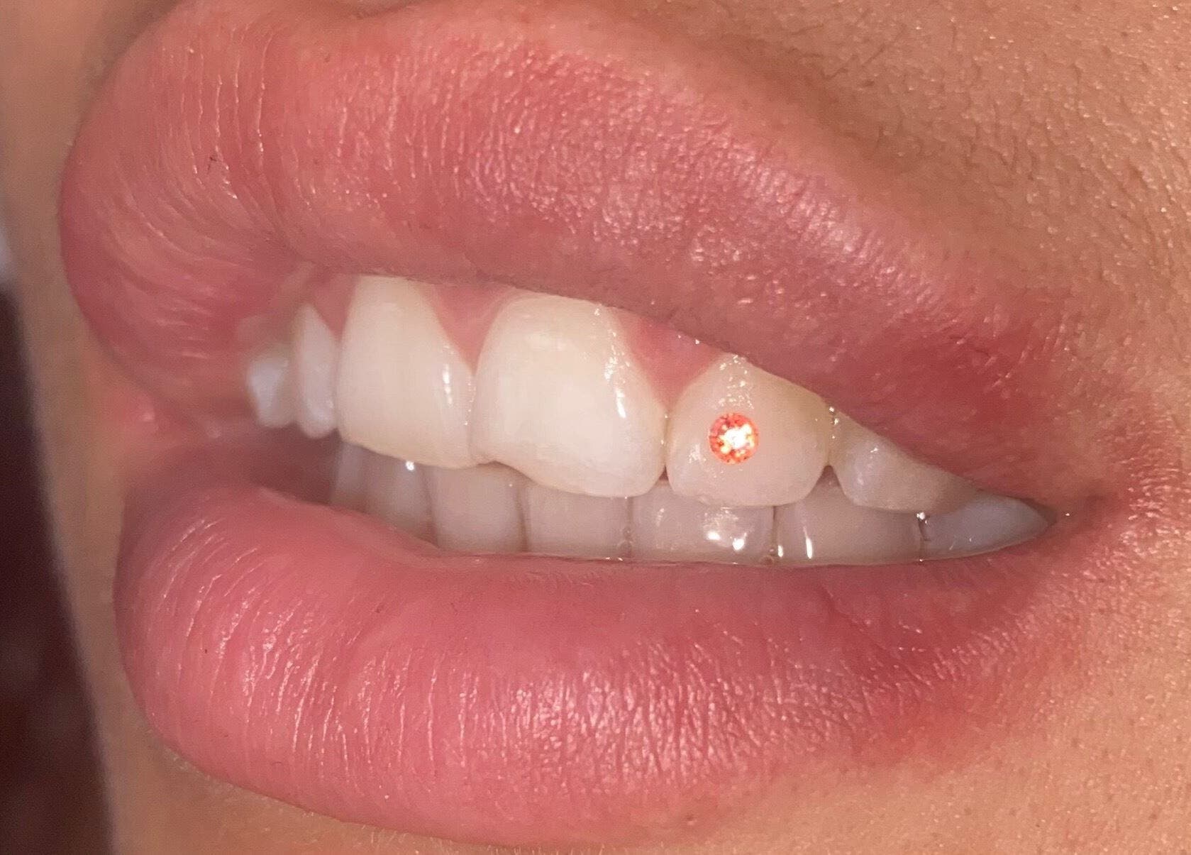 Tooth gem on a smile at ALM Beauty in Brighton And Hove, England, GB, highlighting dental artistry.