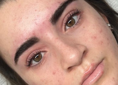 Radiant skin enhancement at Beths Beauty Services in Morphett Vale, South Australia, AU.