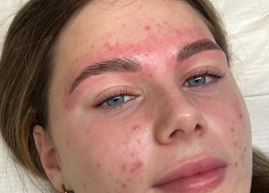 Close-up of a skincare treatment at bethsbeautyservices, Morphett Vale, South Australia, AU.