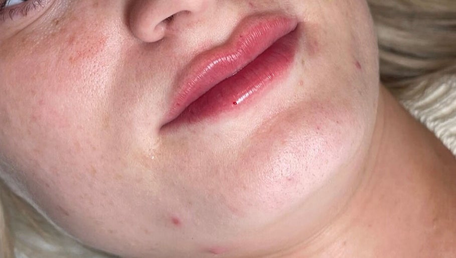 Chloe’s Aesthetics And Healthcare image 1