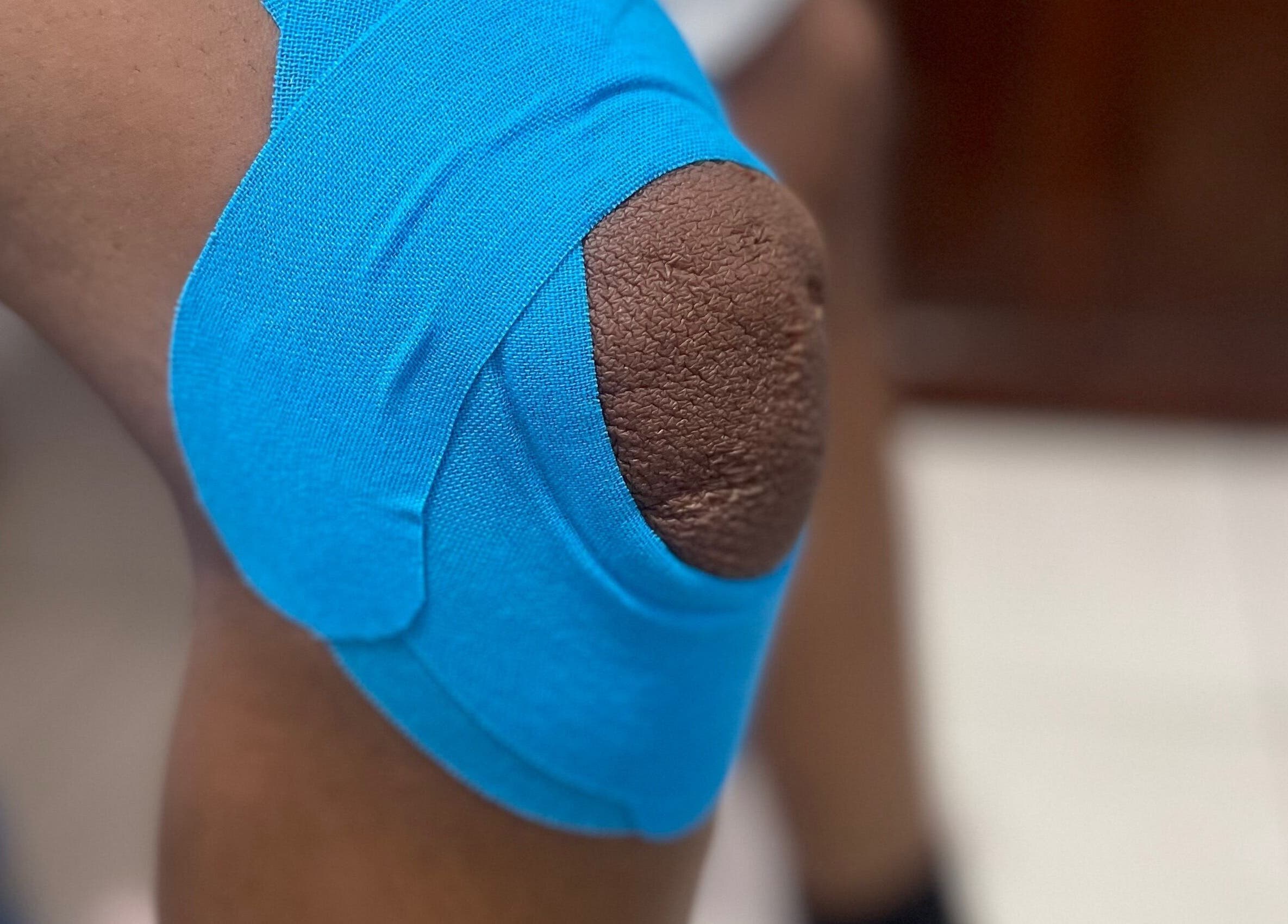 Terapia con cinta azul en la rodilla en Recovery Sport Lab, Santo Domingo, Distrito Nacional, DO.