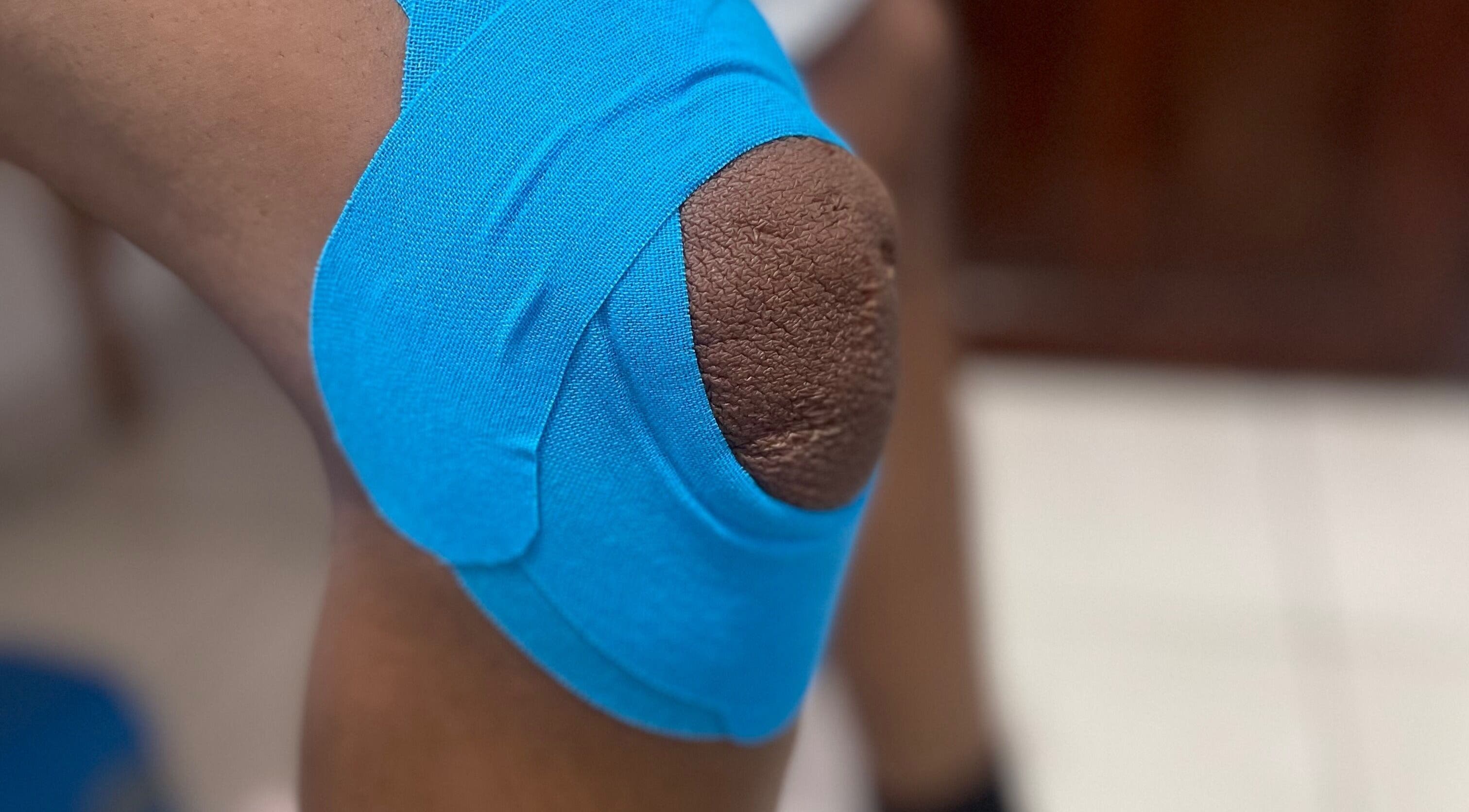 Terapia con cinta azul en la rodilla en Recovery Sport Lab, Santo Domingo, Distrito Nacional, DO.