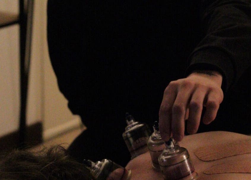 Thérapie par ventouse à Mr Stretch & Massage, Tarnos, Nouvelle-Aquitaine, FR pour bien-être optimal.