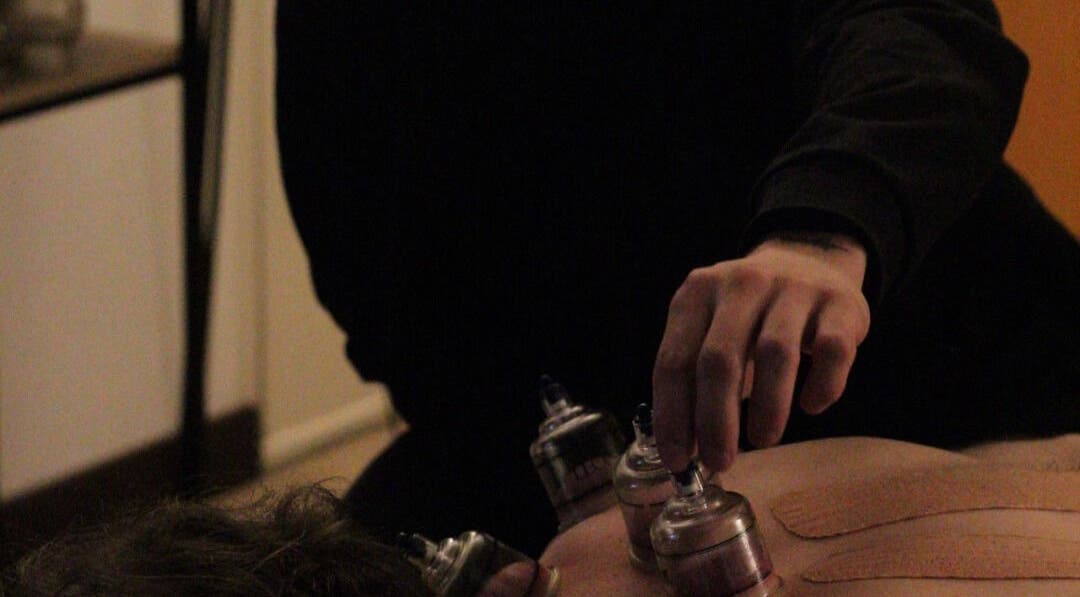 Thérapie par ventouse à Mr Stretch & Massage, Tarnos, Nouvelle-Aquitaine, FR pour bien-être optimal.