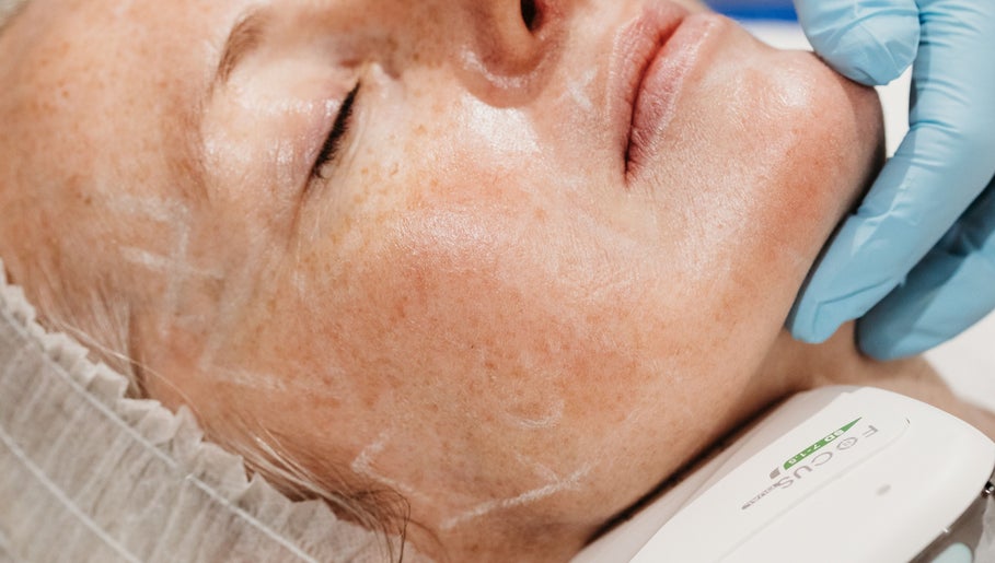 Close-up facial treatment at Mor clinic Rachel Abbie Aesthetics Lelant, St Ives, England, GB.