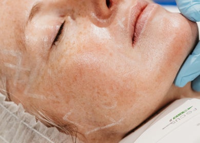 Close-up facial treatment at Mor clinic Rachel Abbie Aesthetics Lelant, St Ives, England, GB.