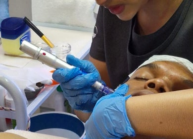 Microneedling facial at Wink Beauty Salon & Spa, Sandton, Gauteng, ZA.