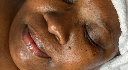 Glowing skin treatment at Sculpted Aesthetic Miami in Miami Lakes, Florida, US.