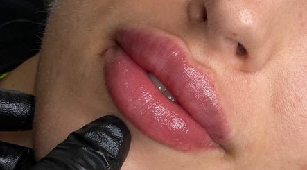 Dp Aesthetics