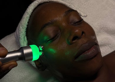 Facial rejuvenation treatment at Beautified By Linda Med Spa & Aesthetic Shop, Lekki, Lagos, NG.