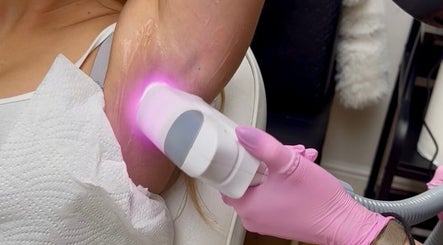 Laser treatment on arm at ER Laser Clinic, Wisbech, England, GB for smooth skin.