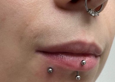 Nose and lip piercings with silver jewelry at ER Laser Clinic, Wisbech, England, GB.