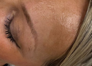 Close-up of smooth skin post-treatment at ER Laser Clinic & Piercing, Wisbech, England, GB.