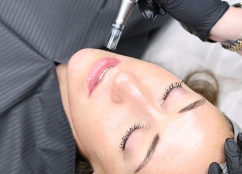 Facial treatment at Impeccable Aesthetics in Warrington, England, enhancing skin clarity and radiance.