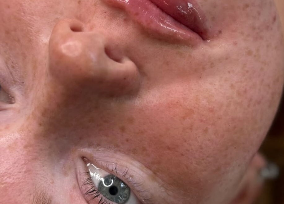 Close-up of a glowing complexion at LJ SKIN & AESTHETICS CLINIC, Oswestry, England, GB.