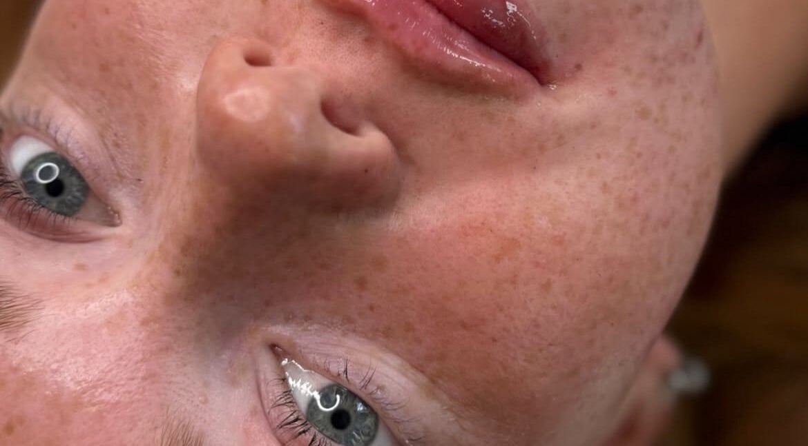 Close-up of a glowing complexion at LJ SKIN & AESTHETICS CLINIC, Oswestry, England, GB.