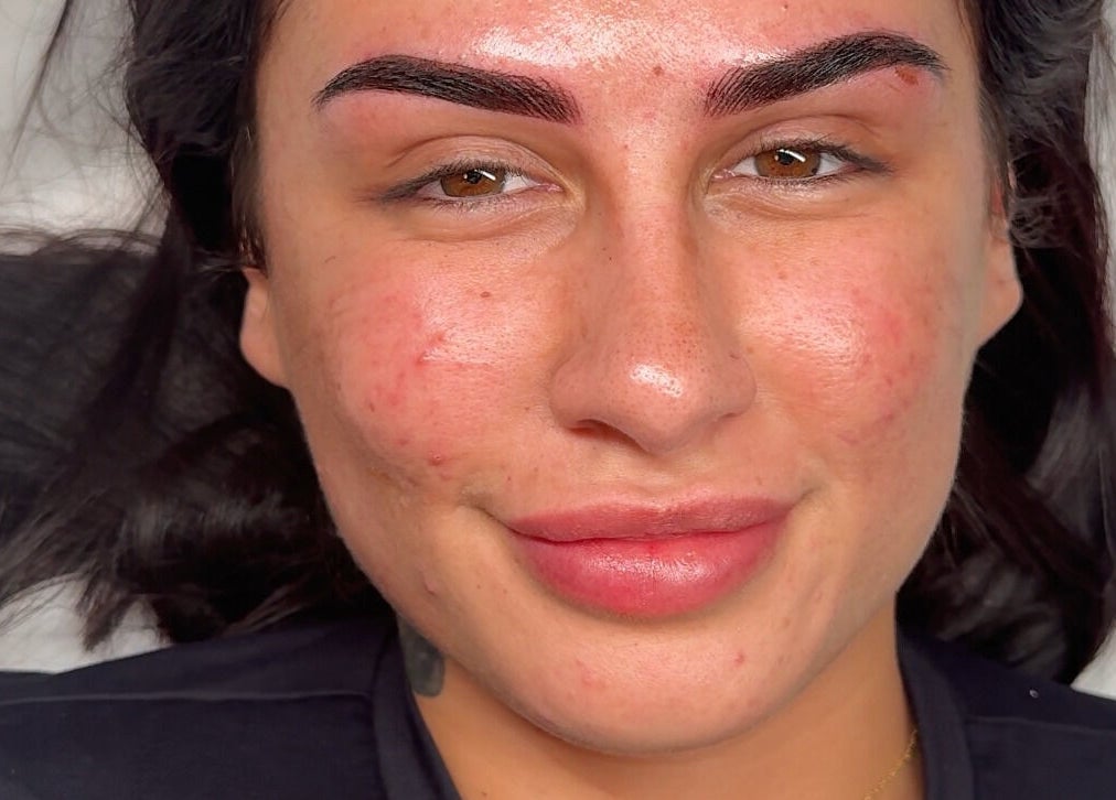 Brow Obsession Specialist's microblading result in Dee Why, New South Wales, AU.