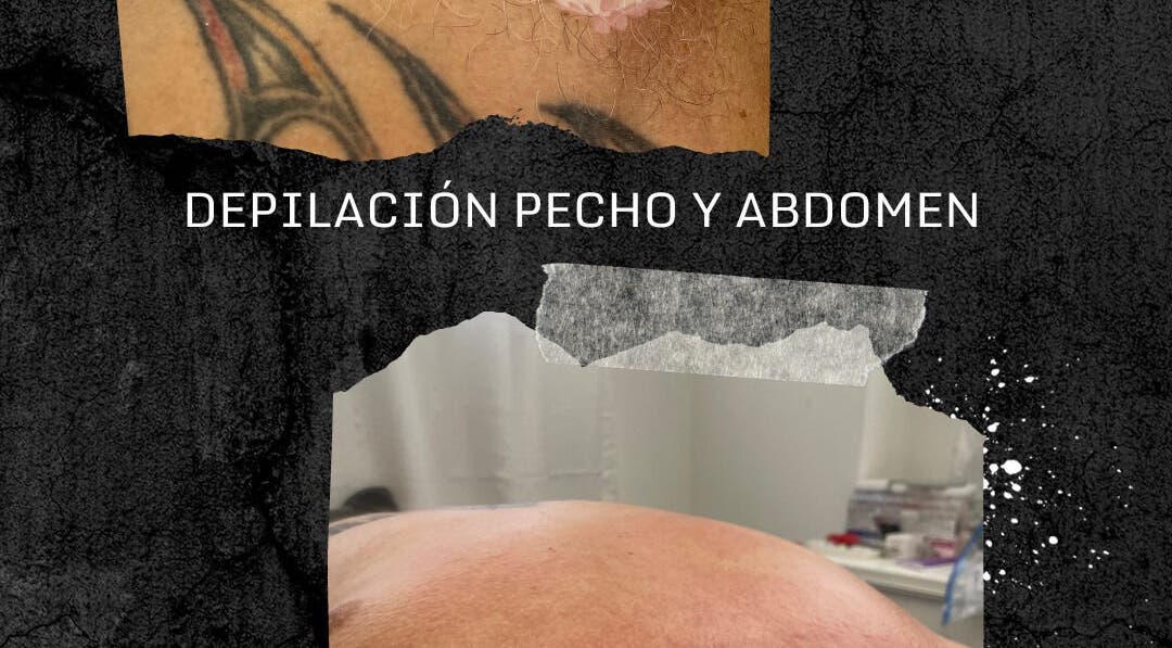 Servicio de depilación de pecho y abdomen en The Waxing Room, Mayagüez, Puerto Rico, US.