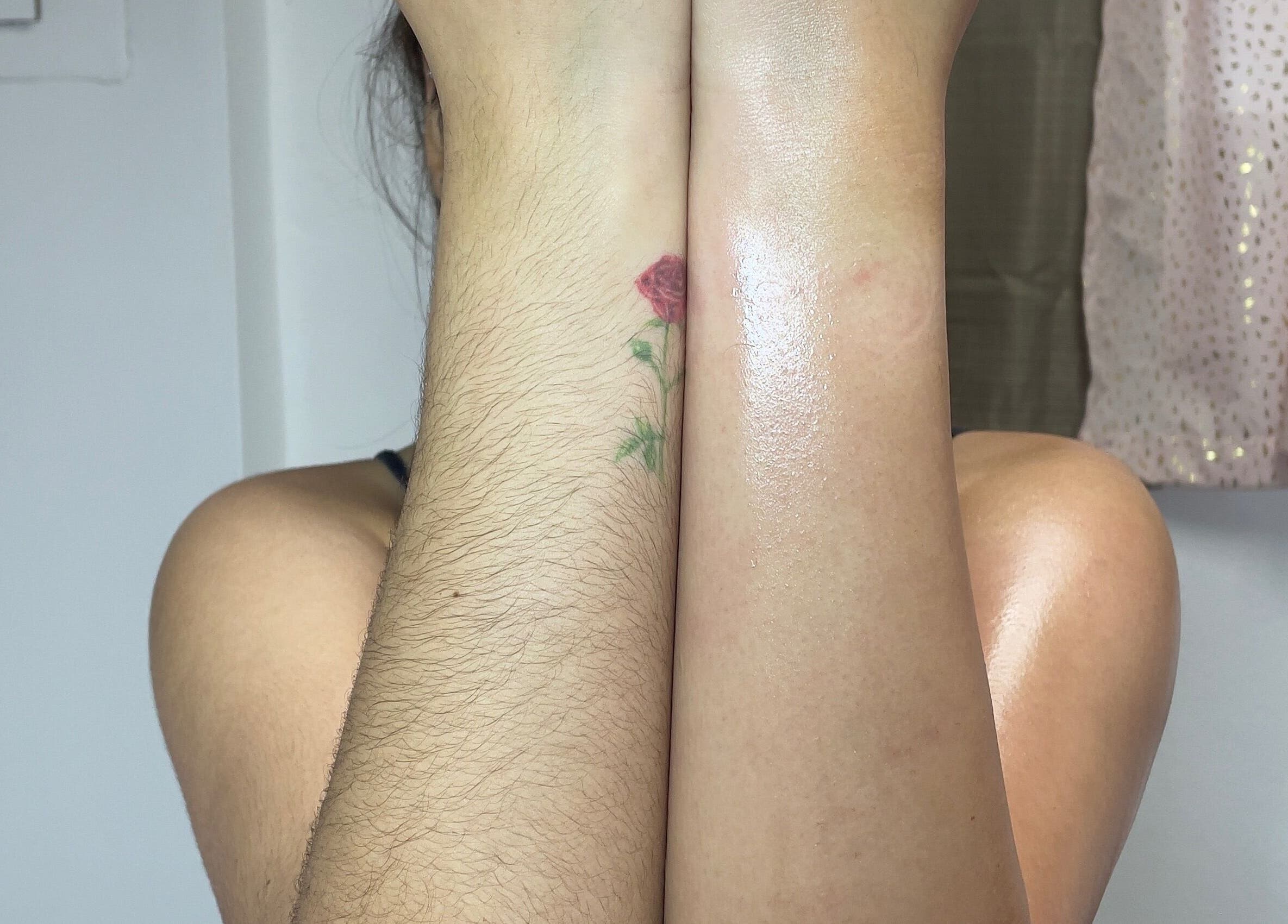 Antes y después del tratamiento en The Waxing Room, Mayaguez, Puerto Rico, US. Resultados suaves en brazos.