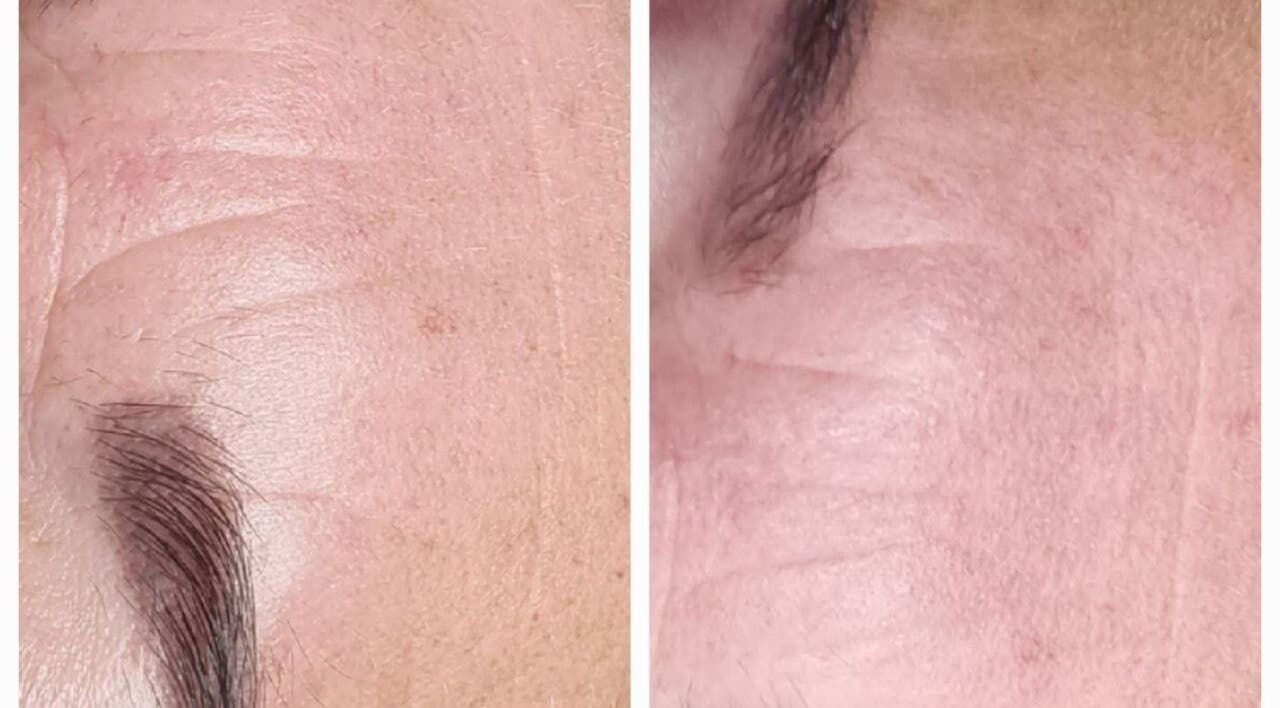 Before and after skin care at BeUCare Esthetics and Wellness Lounge, Paramaribo, Paramaribo, SR.