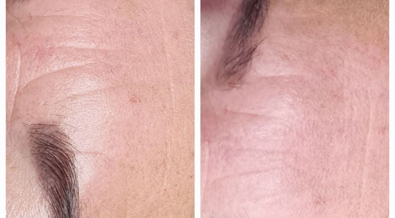 Before and after skin care at BeUCare Esthetics and Wellness Lounge, Paramaribo, Paramaribo, SR.