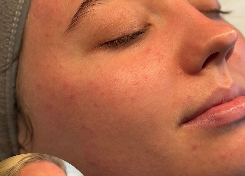 Close-up of a relaxed face during skincare at Pampered by Elaine, Dunfermline, Scotland, GB.