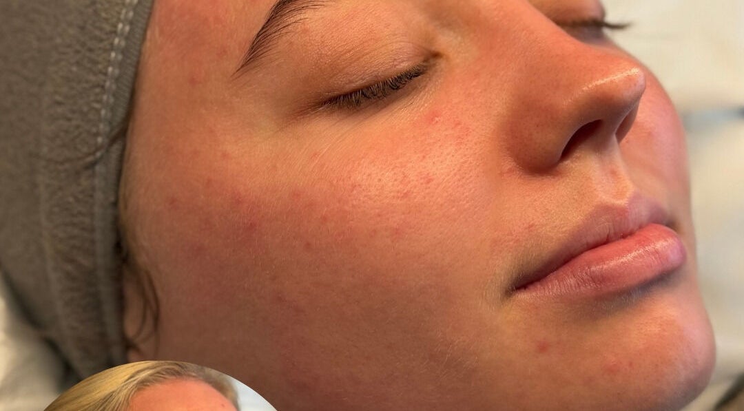 Close-up of a woman's calm face during a facial at Pampered by Elaine, Dunfermline, Scotland, GB.
