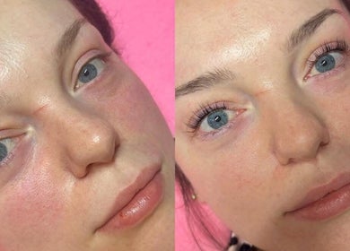 Before and after skincare at Kirsty’s Nails and Beauty, Chopwell, England, GB. Dramatic facial enhancement.