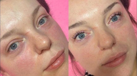 Before and after skincare at Kirsty’s Nails and Beauty, Chopwell, England, GB. Dramatic facial enhancement.