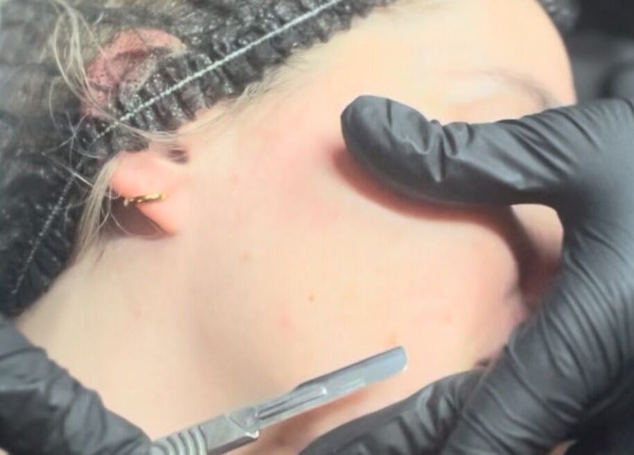 Dermaplaning at Face:it in Borve, Scotland, GB, showcasing precise exfoliation technique.