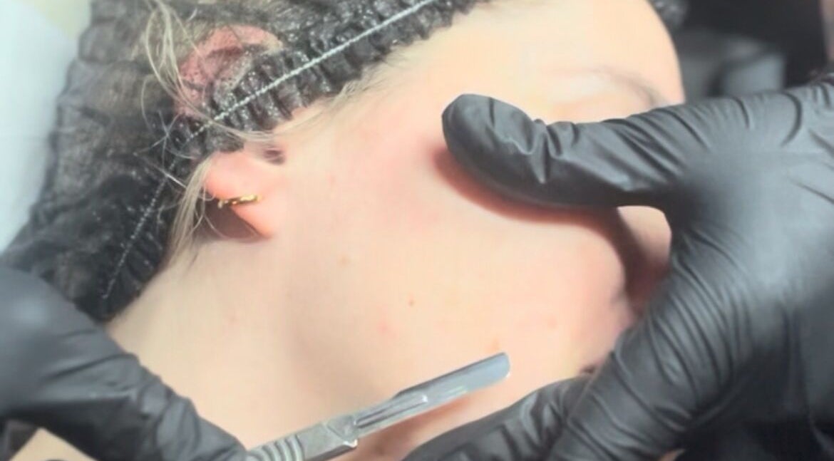Dermaplaning at Face:it in Borve, Scotland, GB, showcasing precise exfoliation technique.