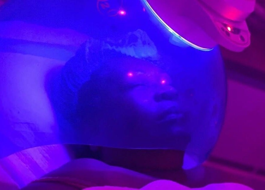 Tratamiento facial LED azul en Skin Perfect Curacao, Willemstad, CW, mejorando el bienestar de la piel.