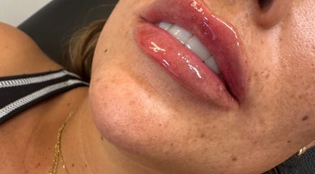 Close-up of shiny lips treated at You Glow Girl Aesthetics and Beauty Maidstone Kent, Maidstone, England, GB.