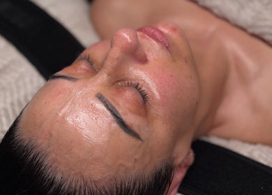 A revitalized face post-treatment at Simply Radiant Skin and Body Clinic in Melbourne, Victoria, AU.