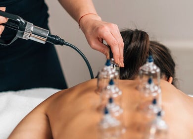Cupping therapy session at Andreia Schweich in Lake Mary, Florida, US, highlighting relaxation and wellness.