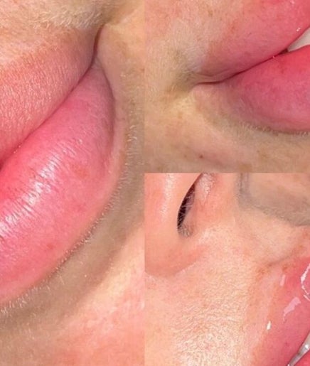 Close-up of glossy lip enhancement at Absolute Aesthetics, Dyce, Scotland, GB.