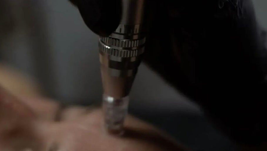 Close-up of microneedling at Beauty By Marina, Thetford, England, GB, showcasing advanced skincare techniques.