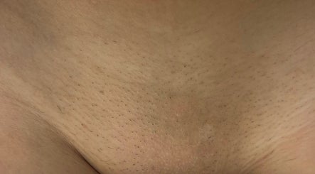 Pearl Laser Clinic image 3