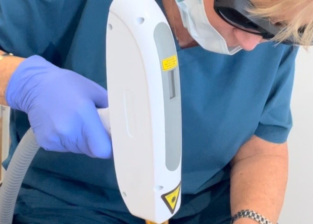 Expert using laser device at Ml Aesthetics, Birmingham, England, GB for advanced skincare treatment.