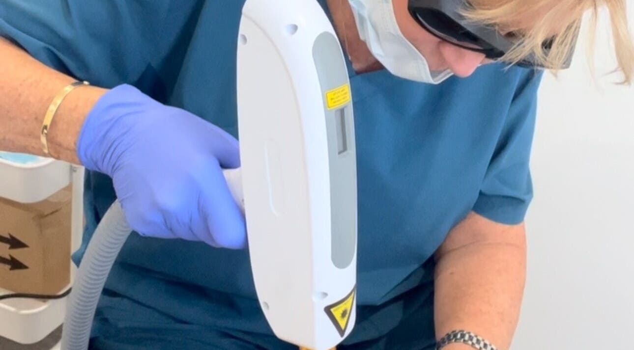 Expert using laser device at Ml Aesthetics, Birmingham, England, GB for advanced skincare treatment.
