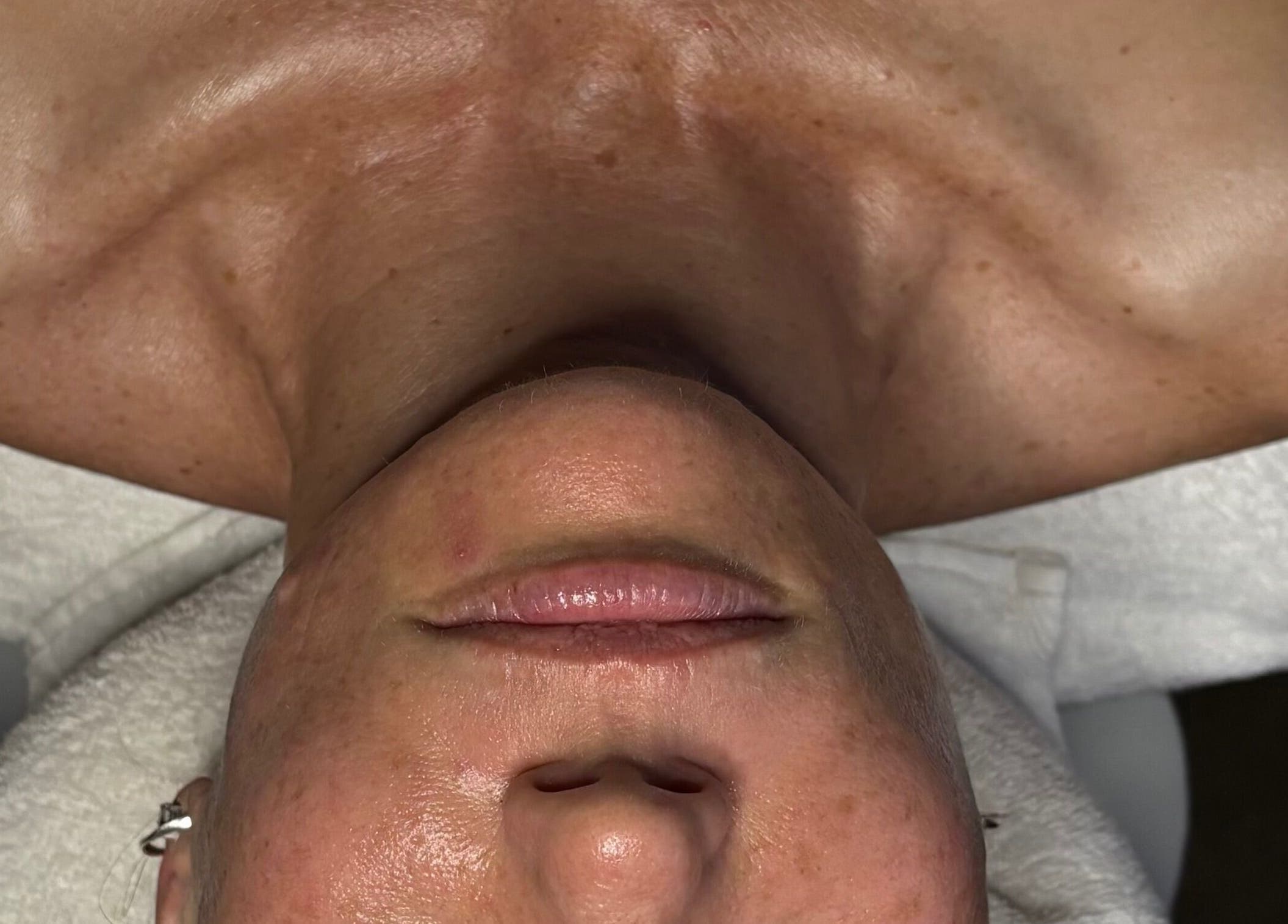 Relaxing facial treatment at Primavera Aesthetics, Olifantsfontein, Gauteng, ZA, highlighting skin rejuvenation.