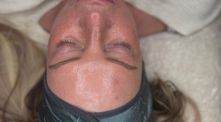 Facial treatment at Natalie Mcintyre Aesthetics, Bishopbriggs, Scotland, GB, showcasing smooth and radiant skin.