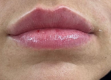 Close-up of lips with gloss at Natalie Mcintyre Aesthetics, Bishopbriggs, Scotland, GB.